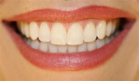 Mouth.